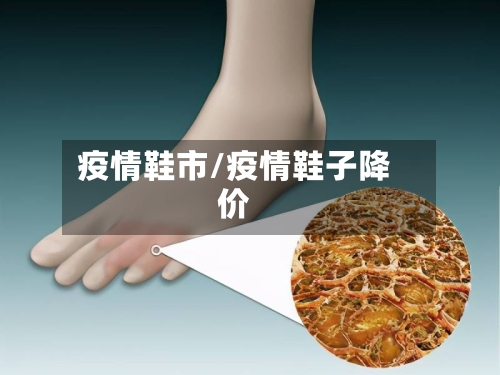 疫情鞋市/疫情鞋子降价