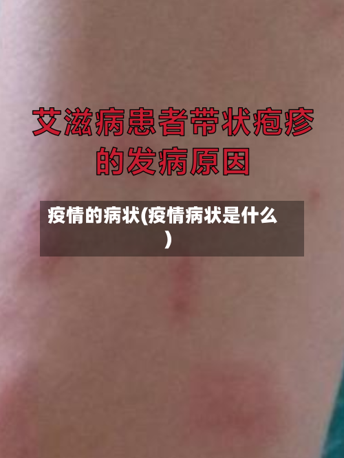 疫情的病状(疫情病状是什么)