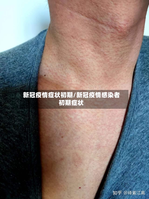 新冠疫情症状初期/新冠疫情感染者初期症状