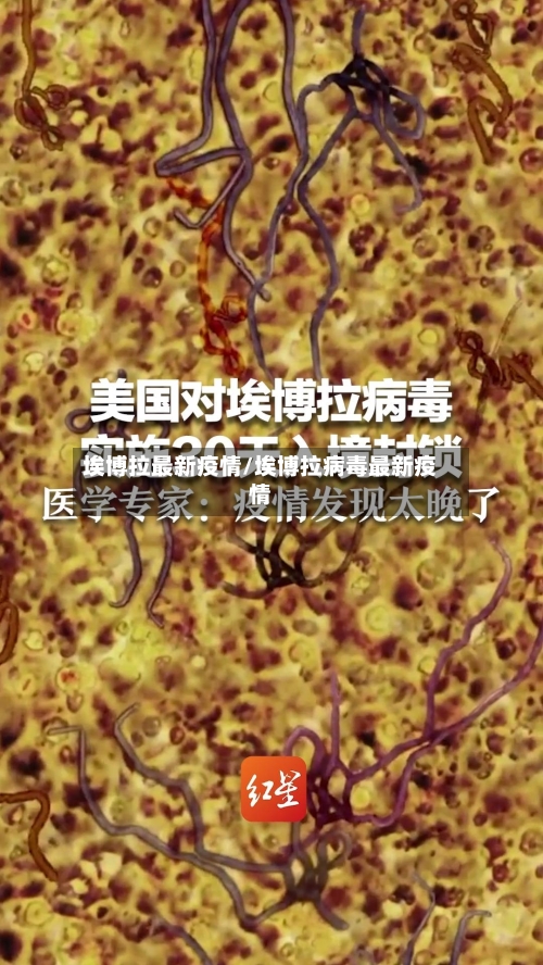 埃博拉最新疫情/埃博拉病毒最新疫情